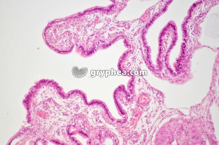 Trompe de Fallope (oviducte) x40 - gryphea.com